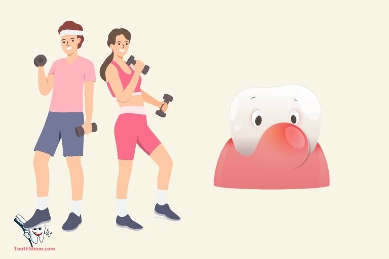 Can I Workout With an Abscessed Tooth