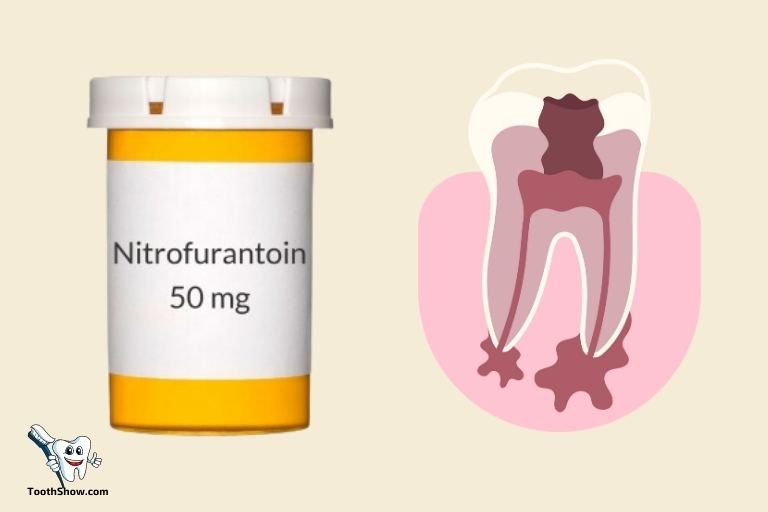 Can Nitrofurantoin Treat Abscess Tooth