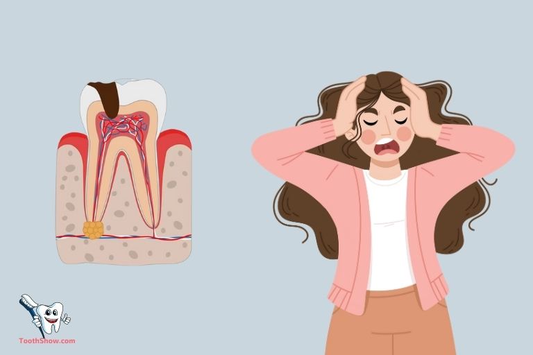 Can Stress Cause Abscess Tooth