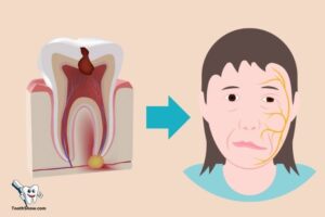 Can Tooth Abscess Cause Facial Paralysis? Yes!