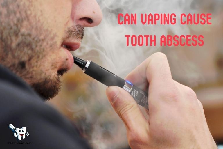 Can Vaping Cause Tooth Abscess
