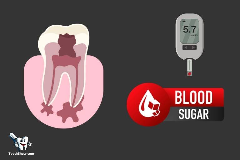 Can a Tooth Abscess Cause High Blood Sugar