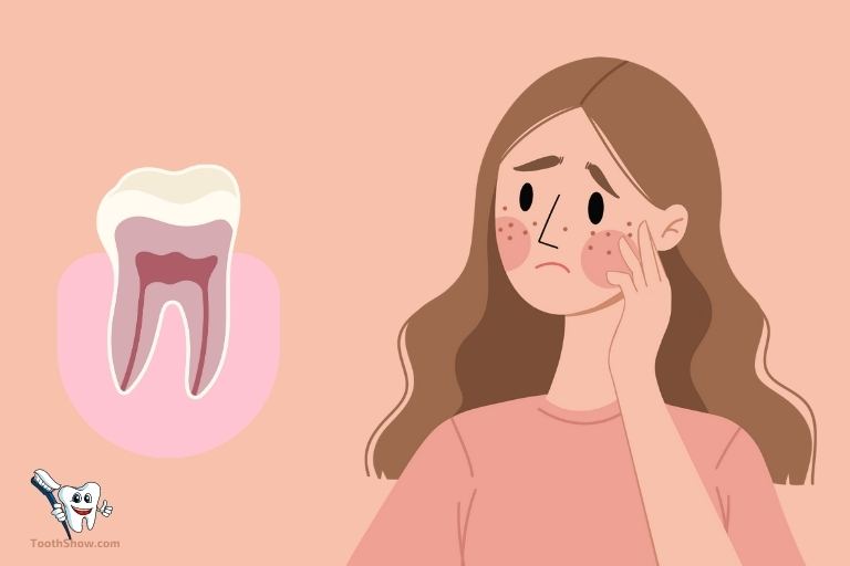 Can an Abscessed Tooth Cause Acne