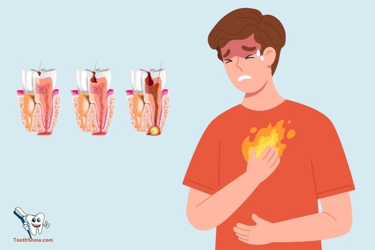 Can an Abscessed Tooth Cause Heartburn