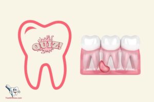 Do I Have a Tooth Abscess Quiz? 10 Quiz!