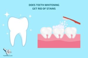 Does Teeth Whitening Get Rid of Stains? Yes!