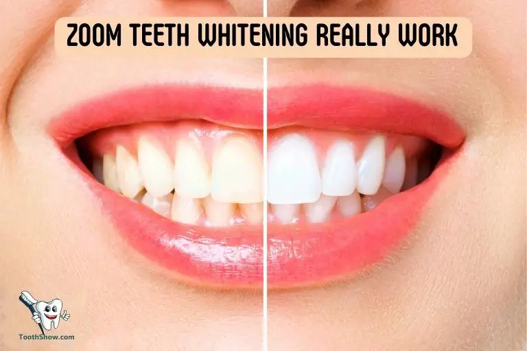 Does Zoom Teeth Whitening Really Work