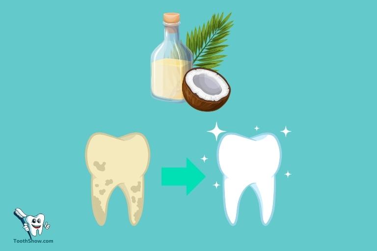 How to Use Coconut Oil for Teeth Whitening