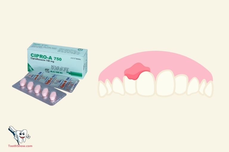 Is Cipro Good for Tooth Abscess
