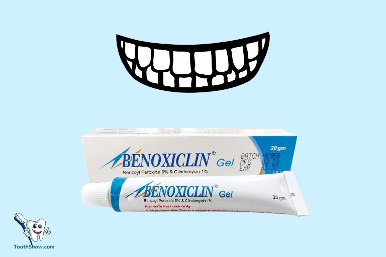 Peroxide Gel Teeth Whitening Side Effects