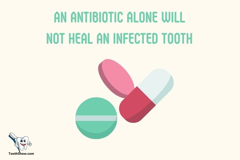 What Happens If Antibiotics Dont Work for Tooth Abscess