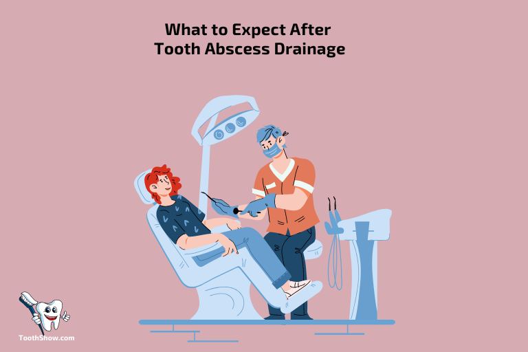 What to Expect After Tooth Abscess Drainage1