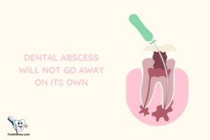Will Tooth Abscess Drain on Its Own? Dental Care