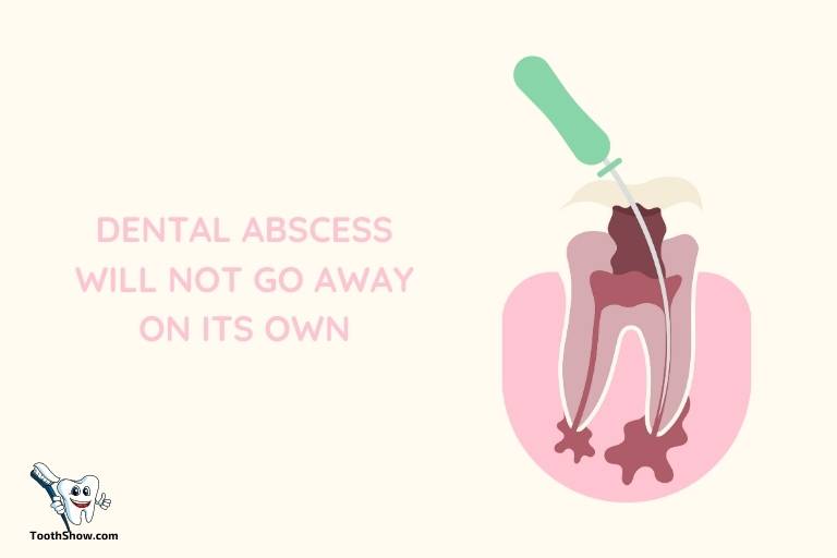 will tooth abscess drain on its own