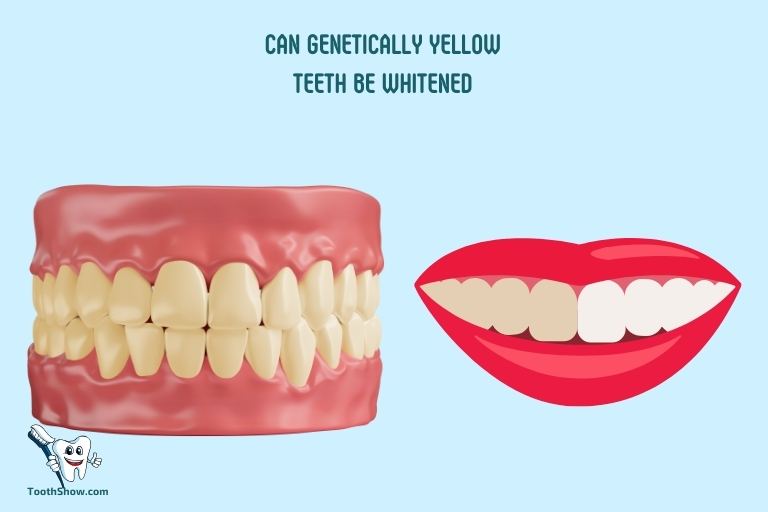 Can Genetically Yellow Teeth Be Whitened