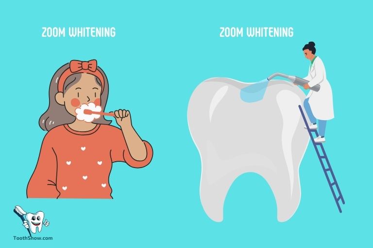 Can I Brush My Teeth After Zoom Whitening