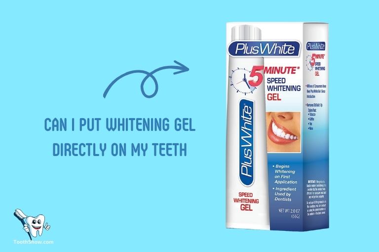 Can I Put Whitening Gel Directly on My Teeth