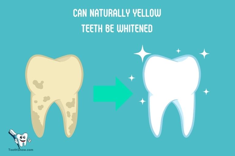 Can Naturally Yellow Teeth Be Whitened