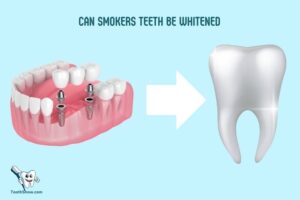 Can Smokers Teeth Be Whitened? Yes!