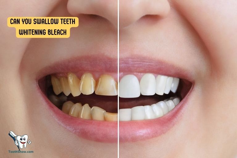 Can You Swallow Teeth Whitening Bleach