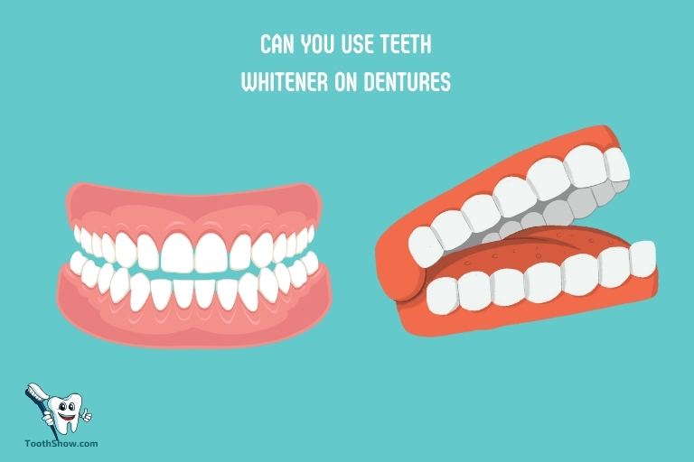 Can You Use Teeth Whitener on Dentures