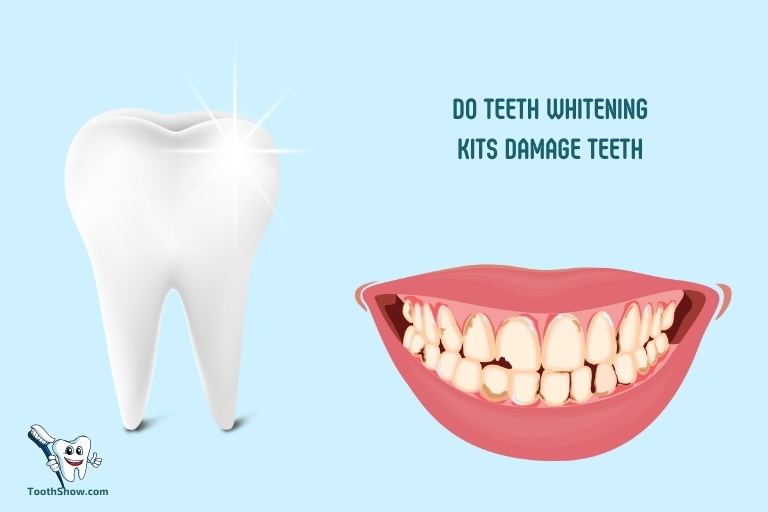 Do Teeth Whitening Kits Damage Teeth