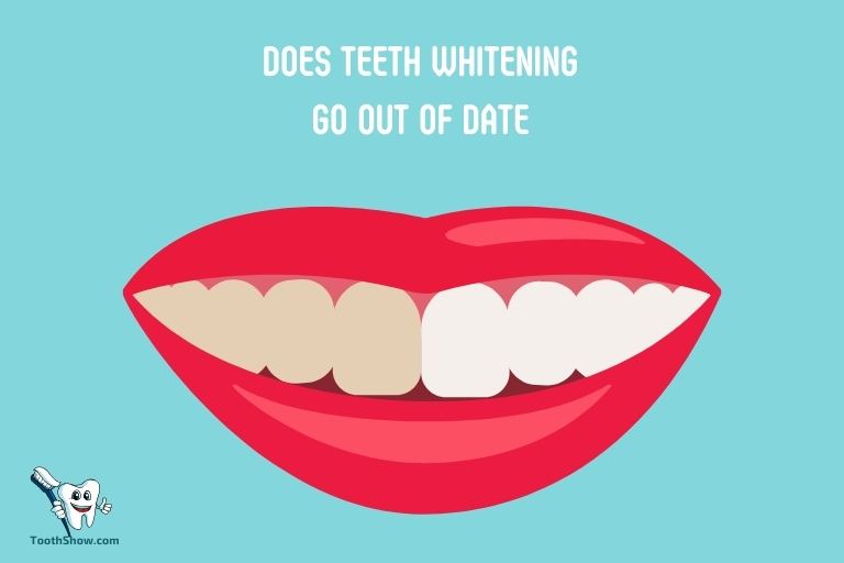 Does Teeth Whitening Go Out of Date