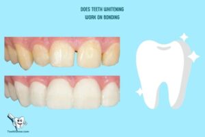 Does Teeth Whitening Work on Bonding? No!