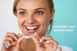 How Can You Get Your Teeth Whitened? 5 Easy Methods!