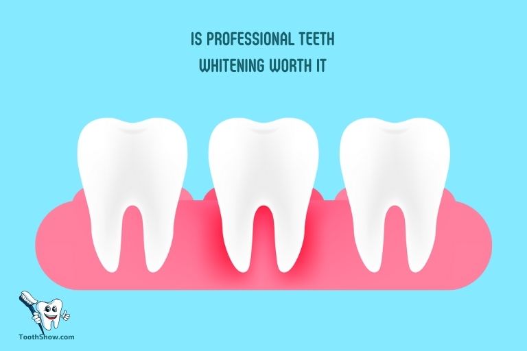 Is Professional Teeth Whitening Worth It