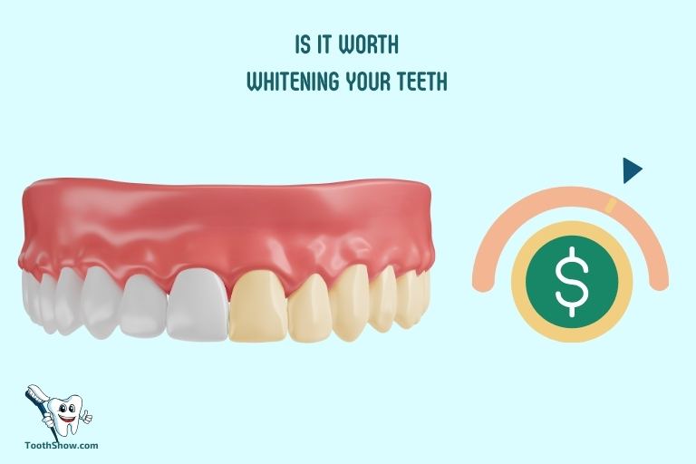 Is it Worth Whitening Your Teeth