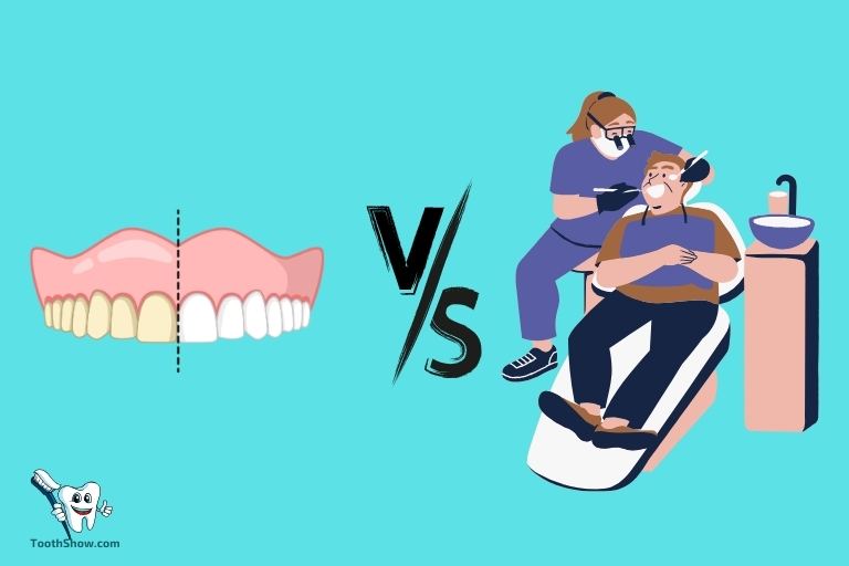 Over the Counter Teeth Whitening Vs Dentist