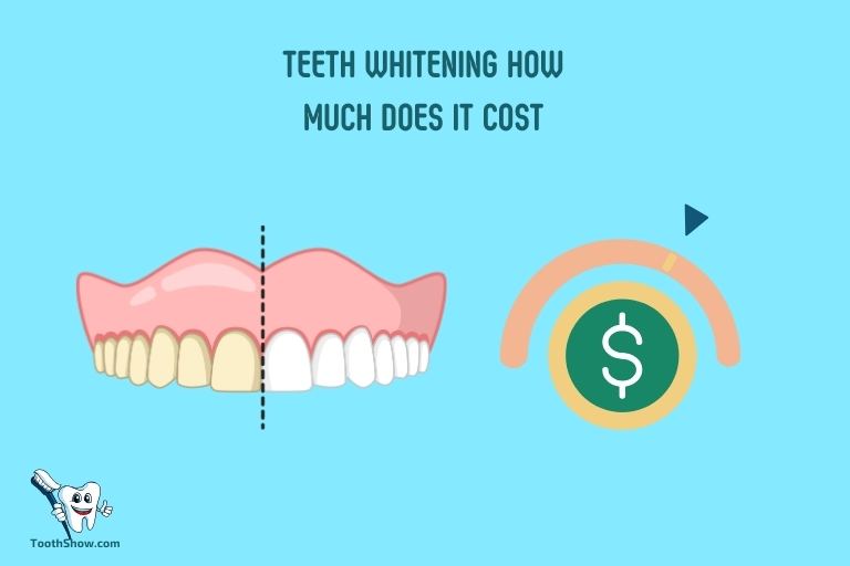 Teeth Whitening How Much Does it Cost