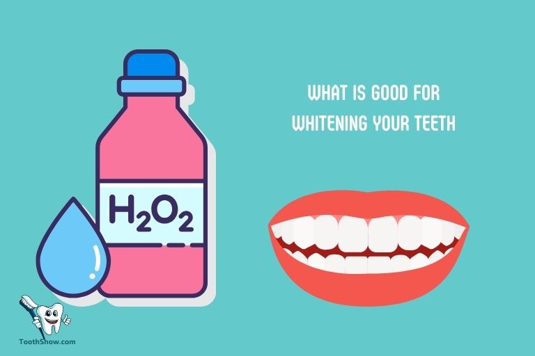 What Is Good for Whitening Your Teeth