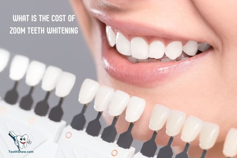 What Is the Cost of Zoom Teeth Whitening