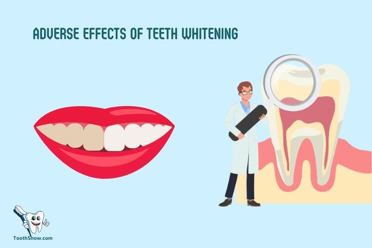 Adverse Effects of Teeth Whitening