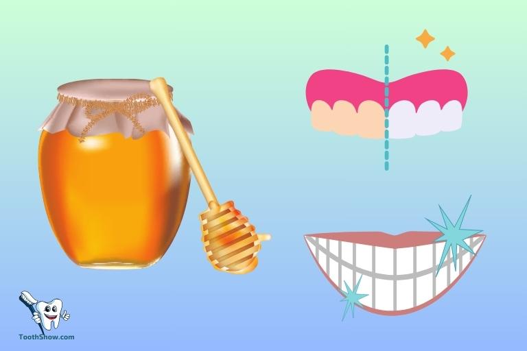 Can I Eat Honey After Teeth Whitening