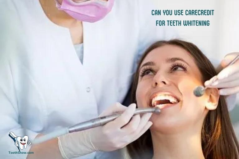 Can You Use Carecredit for Teeth Whitening