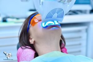 Does Laser Teeth Whitening Last? Few Years!