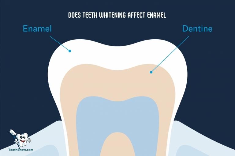 Does Teeth Whitening Affect Enamel