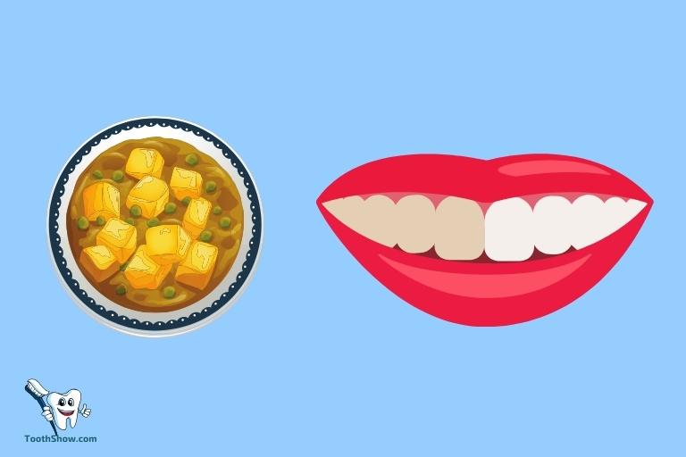 Can I Eat Curry After Teeth Whitening
